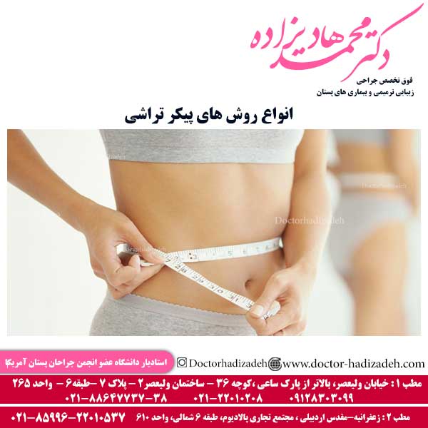 انواع روش های پیکرتراشی - دکتر هادیزاده