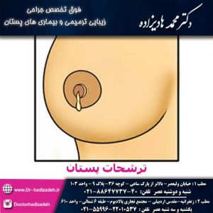 ترشحات-پستان - دکتر هادیزاده