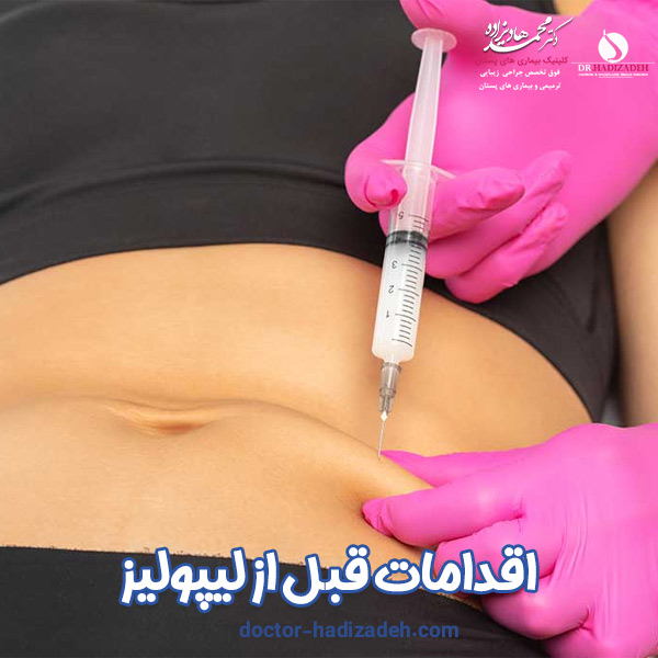اقدامات قبل از لیپولیز - دکتر هادیزاده