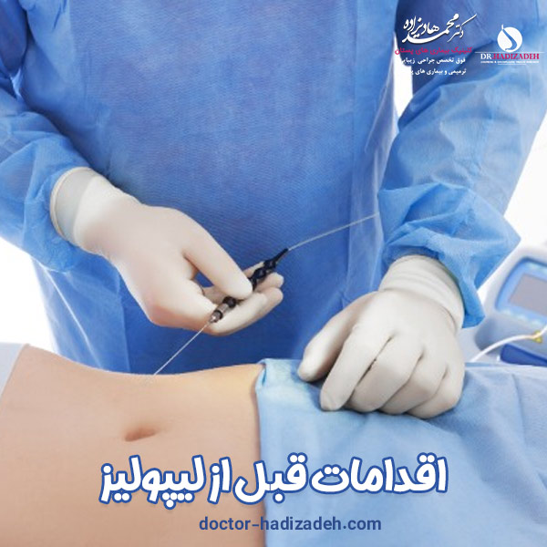 اقدامات قبل از لیپولیز - دکتر هادیزاده