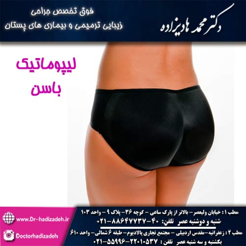 لیپوماتیک باسن