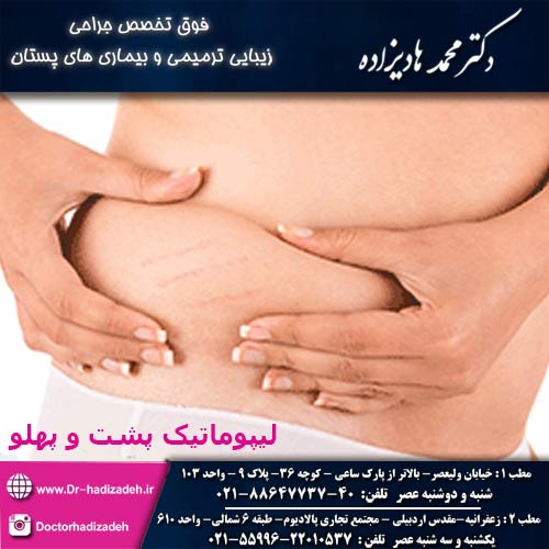 لیپوماتیک پهلو و پشت