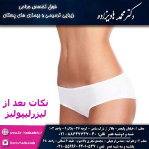 نکات بعد از لیزرلیپولیز