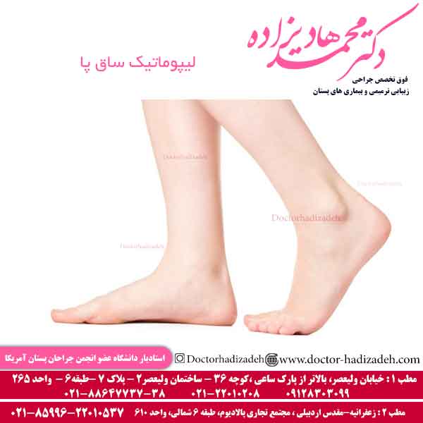 لیپوماتیک ساق پا