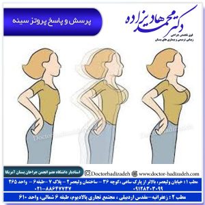 پرسش و پاسخ پروتز سینه
