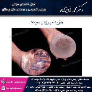 هزینه پروتز سینه