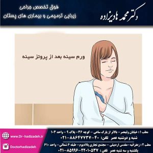ورم سینه بعد از پروتز سینه