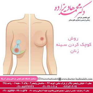 روش کوچک کردن سینه زنان