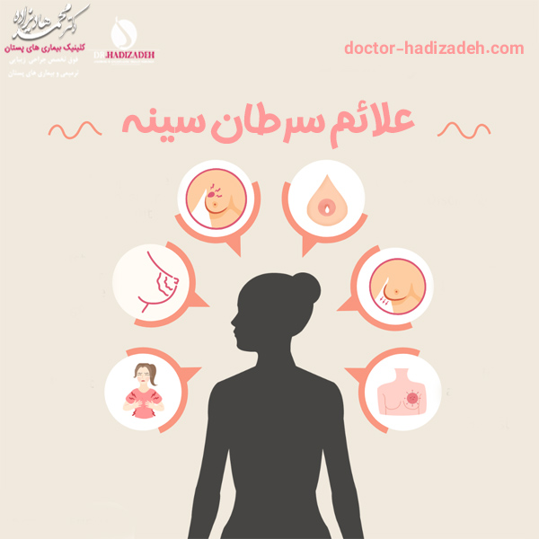 علائم سرطان سینه - دکتر هادیزاده