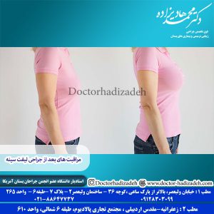 مراقبت های بعد از جراحی لیفت سینه