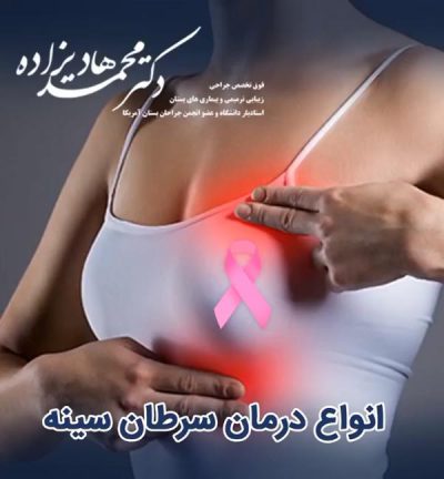 انواع درمان سرطان سینه - دکتر هادیزاده