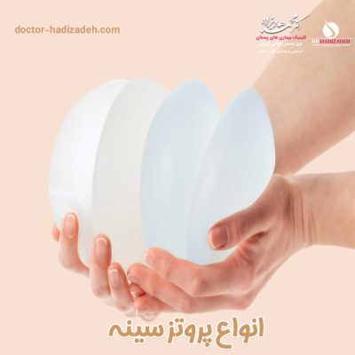 انواع پروتز سینه - دکتر هادیزاده