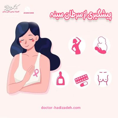 پیشگیری از سرطان پستان - دکتر هادیزاده