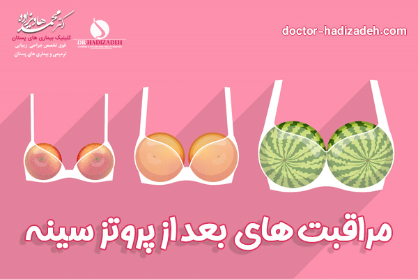 مراقبت های بعد از پروتز سینه - دکتر محمد هادیزاده