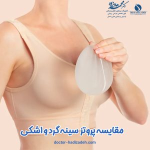 پروتز سینه - دکتر هادیزاده