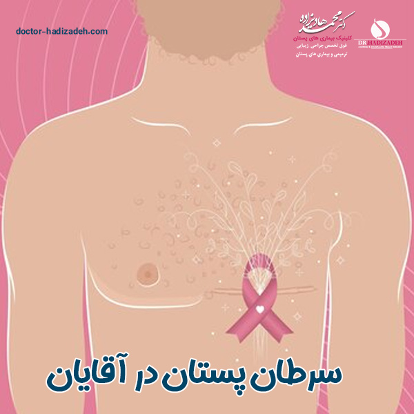 سرطان پستان در آقایان - دکتر هادیزاده