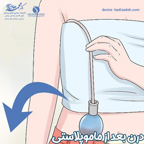درن بعد از ماموپلاستی | دکتر هادیزاده