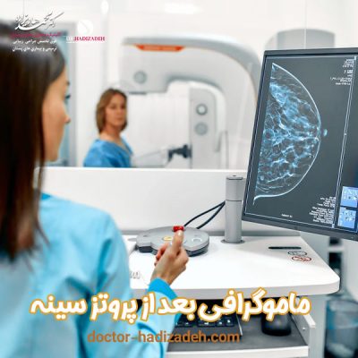 ماموگرافی بعد از پروتز سینه - دکتر هادیزاده