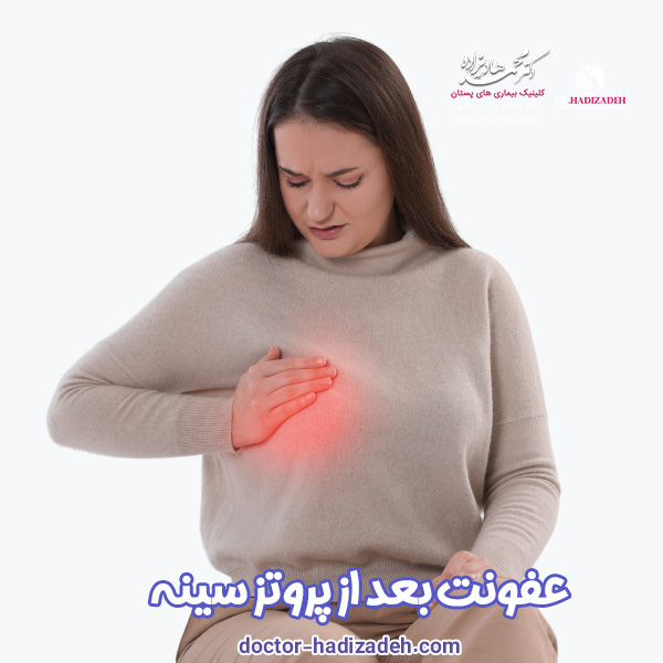 عفونت بعد از پروتز سینه - دکتر هادیزاده