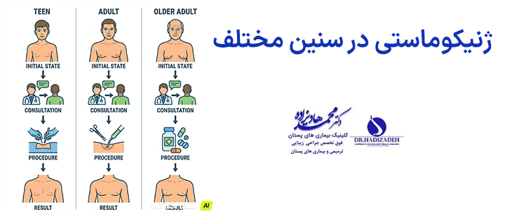ژنیکوماستی در سنین مختلف