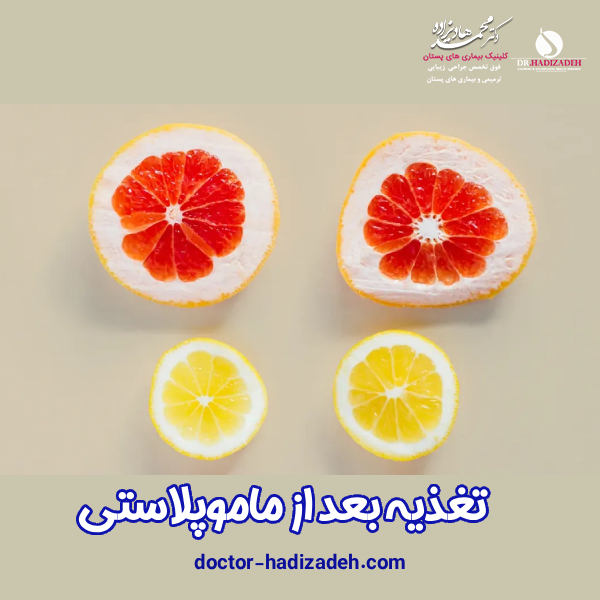 بعد از ماموپلاستی چی بخوریم ؟| دکتر هادیزاده