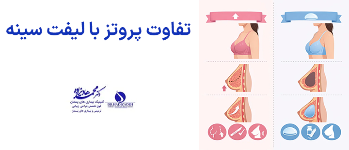 تفاوت پروتز با لیفت سینه