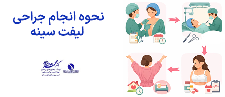 نحوه انجام جراحی لیفت سینه