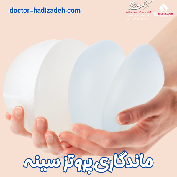ماندگاری پروتز سینه - دکتر محمد هادیزاده