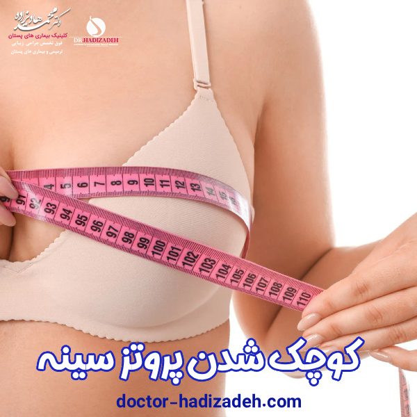 کوچک شدن پروتز سینه - دکتر محمد هادیزاده