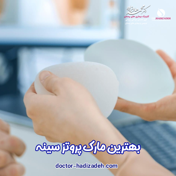 بهترین مارک پروتز سینه - دکتر محمد هادیزاده