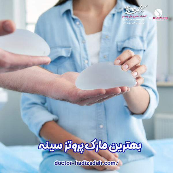 بهترین مارک پروتز سینه - دکتر محمد هادیزاده