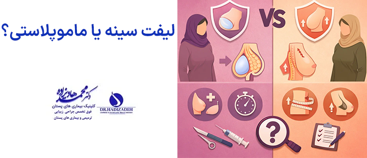 لیفت سینه یا ماموپلاستی؟