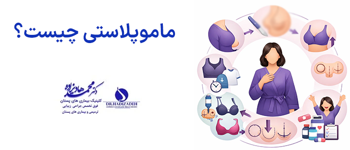 ماموپلاستی چیست؟